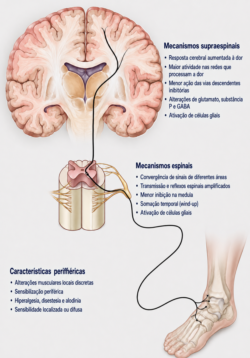 Ilustração biomédica mostrando nervos periféricos, medula espinal e cérebro conectados por vias ascendentes amplificadas e vias descendentes inibitórias reduzidas.