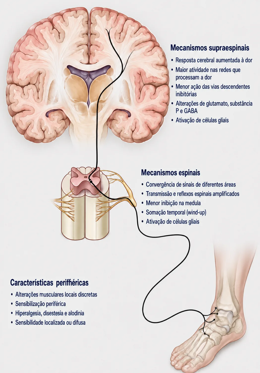 Ilustração biomédica mostrando nervos periféricos, medula espinal e cérebro conectados por vias ascendentes amplificadas e vias descendentes inibitórias reduzidas